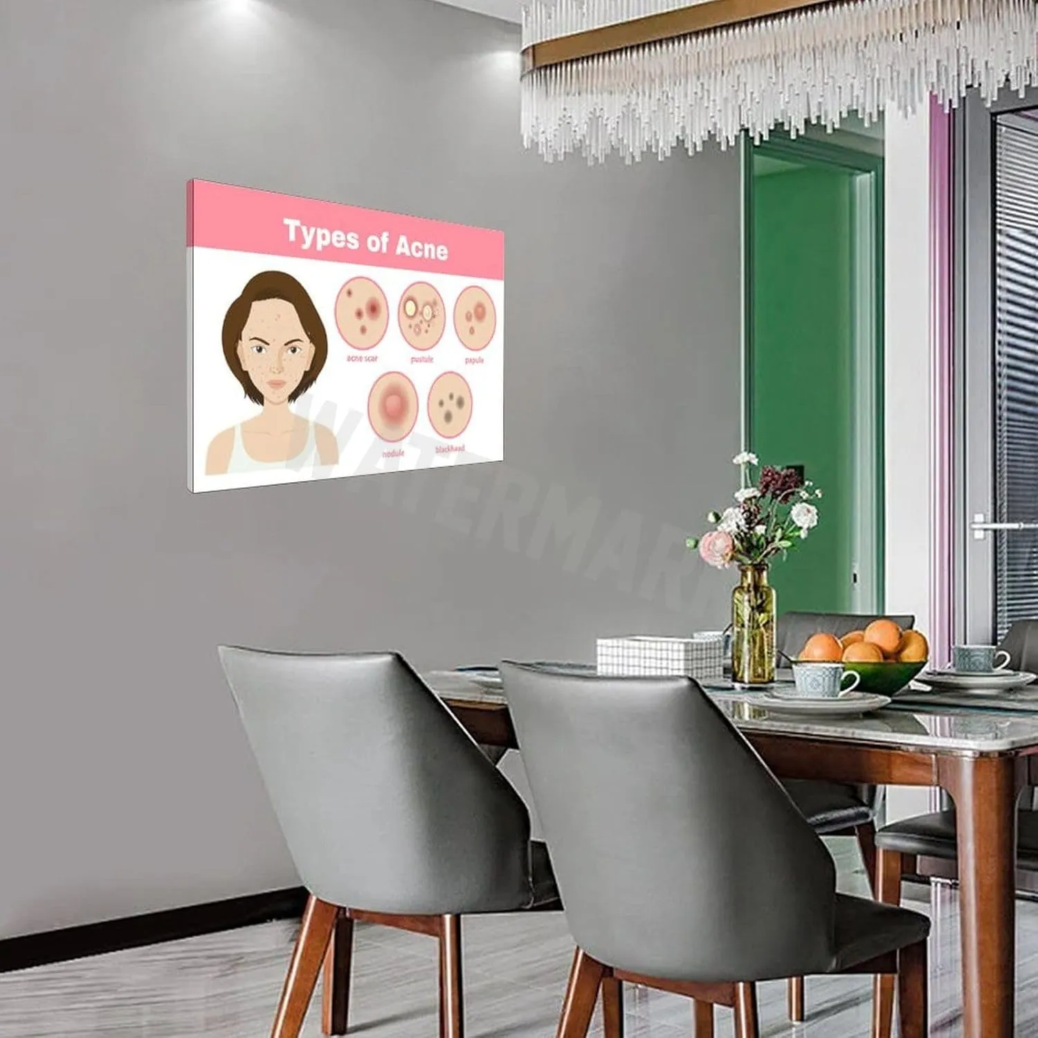 INSTR Beauty Salon Poster Acne Type Guide Art Wall Poster Wall Poster Art Canvas Printing Poster Office Bedroom Aesthetic Poster Frame-style 24x16inch(60x40cm)