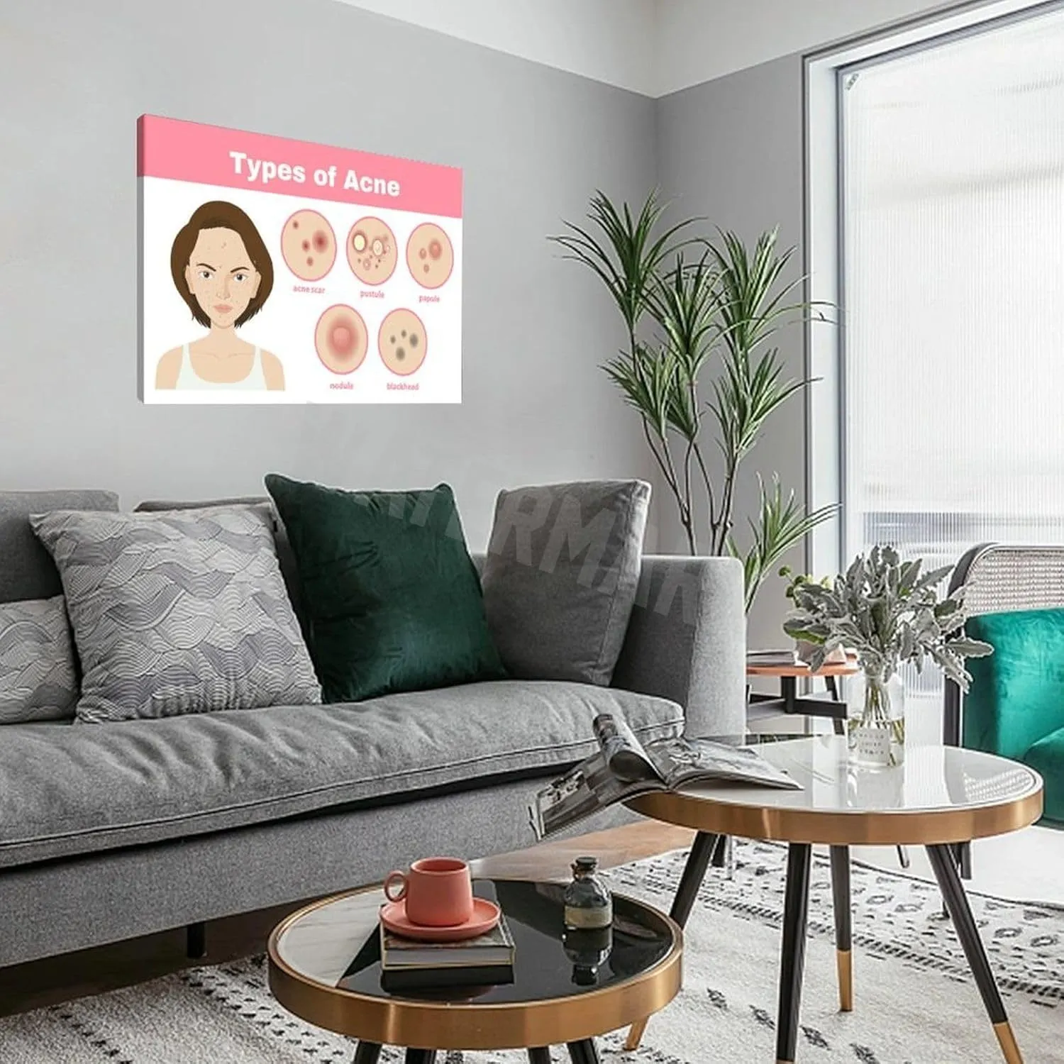 INSTR Beauty Salon Poster Acne Type Guide Art Wall Poster Wall Poster Art Canvas Printing Poster Office Bedroom Aesthetic Poster Frame-style 24x16inch(60x40cm)