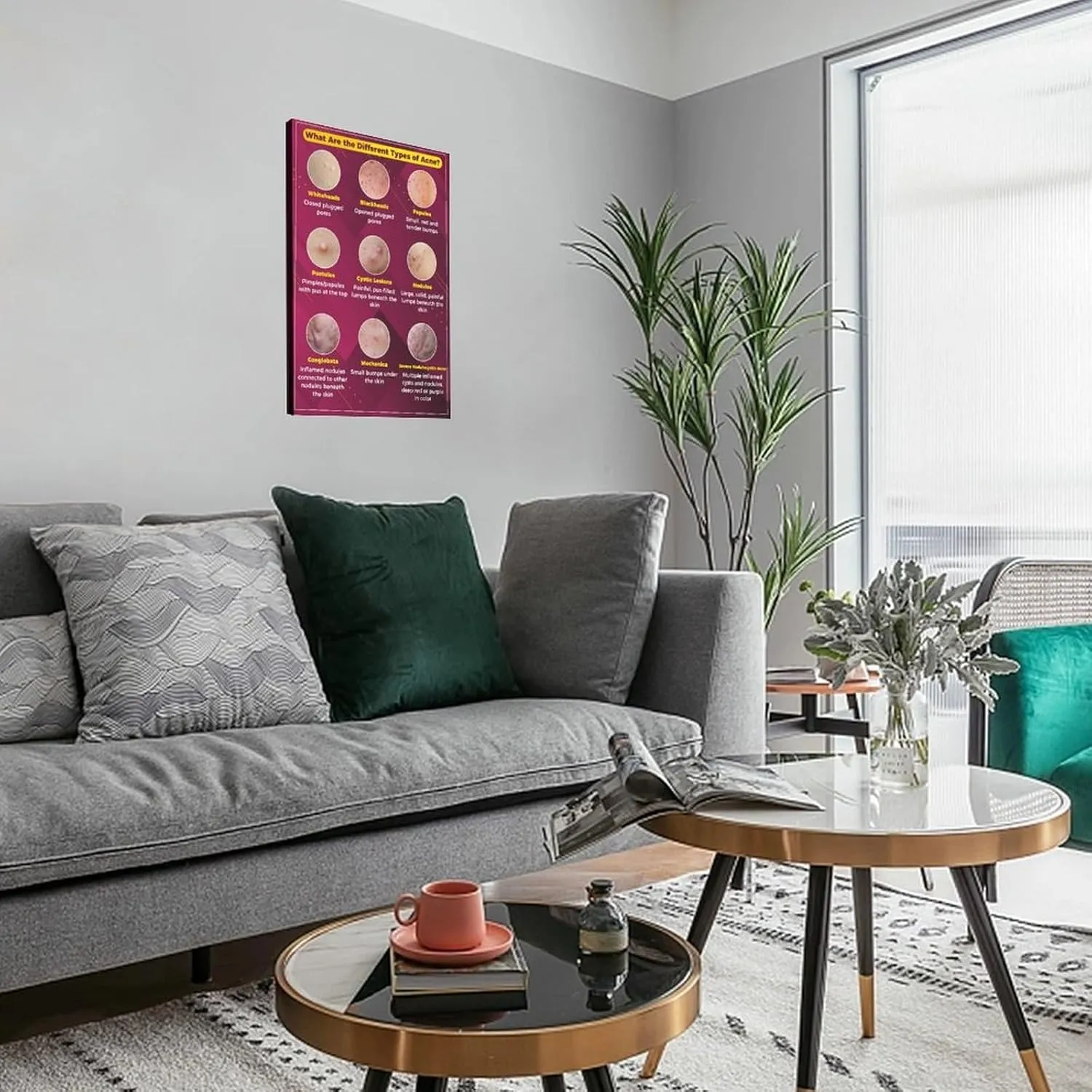 Types of Acne Poster Medical Beauty Poster (3) Wall Poster Art Canvas Printing Living Room Office Bedroom Aesthetic Poster 24x36inch(60x90cm) Frame-style