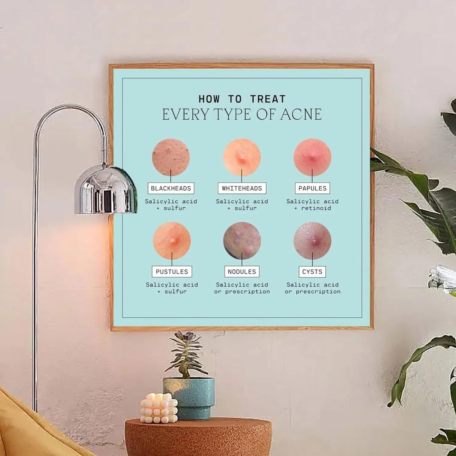 Types of Acne Poster Medical Beauty Poster (6) Wall Poster Art Canvas Printing Living Room Office Bedroom Aesthetic Poster 20x20inch(50x50cm) Frame-style