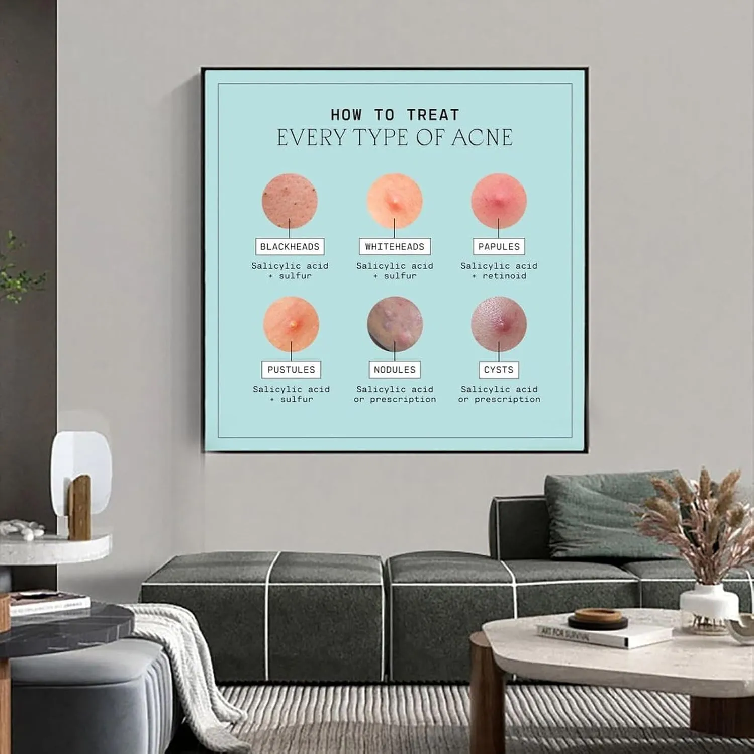 Types of Acne Poster Medical Beauty Poster (6) Wall Poster Art Canvas Printing Living Room Office Bedroom Aesthetic Poster 20x20inch(50x50cm) Frame-style